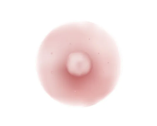 유두·유륜미백 시술 후 사진