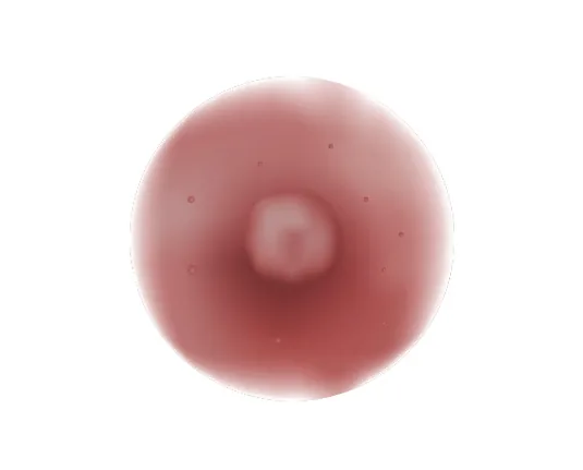 유두·유륜미백 시술 전 사진