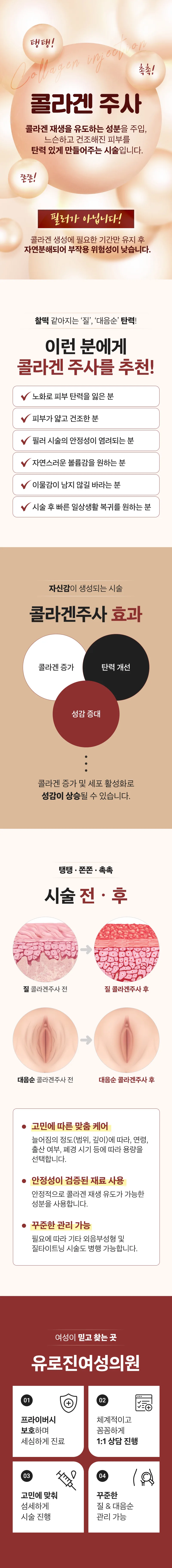 콜라겐 주사 소개 - 콜라겐 재생을 유도하는 성분을 주입해 탄력을 만드는 시술. 추천 대상, 효과, 시술 전후와 유로진 진료 안내