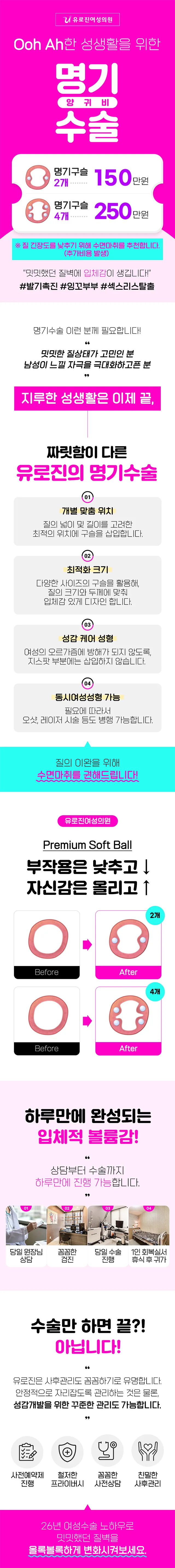 명기수술 이벤트 - 명기구슬 2개 150만원, 4개 250만원. 유로진 명기수술의 특징 4가지, 시술 전후와 당일 진행 과정 안내