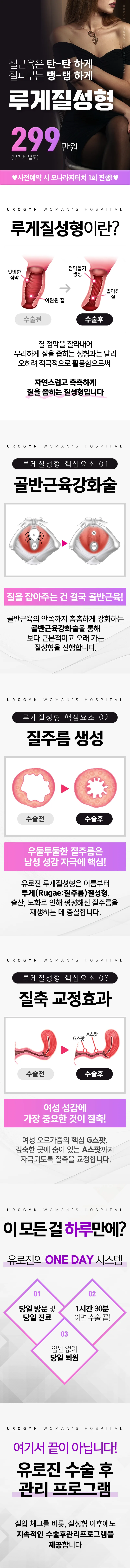 루게질성형 이벤트 - 299만원(부가세 별도), 사전예약 시 모나라지터치 1회 진행. 핵심요소 3가지(골반근육강화술·질주름 생성·질축 교정효과)와 ONE DAY 시스템 안내