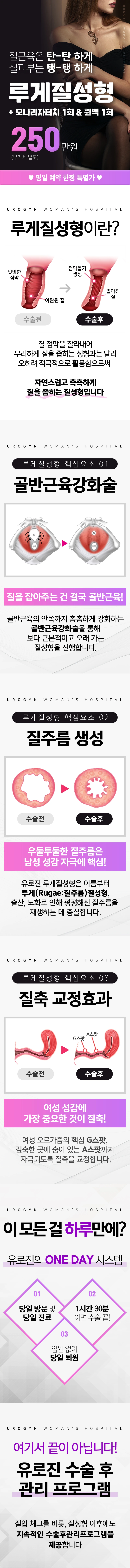 루게질성형 이벤트 - 모나리자터치 1회와 윈백 1회 포함 250만원(부가세 별도), 평일 예약 한정 특별가. 핵심요소 3가지(골반근육강화술·질주름 생성·질축 교정효과)와 ONE DAY 시스템 안내