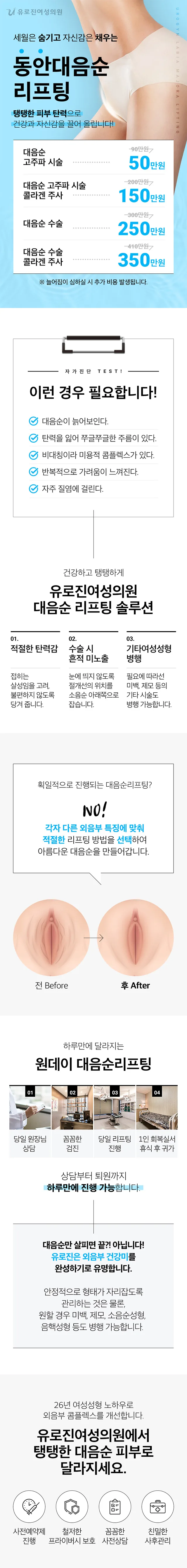 대음순 리프팅 이벤트 - 고주파 시술 50만원, 고주파+콜라겐 주사 150만원, 수술 250만원, 수술+콜라겐 주사 350만원. 자가진단 체크리스트와 원데이 진행 과정 안내