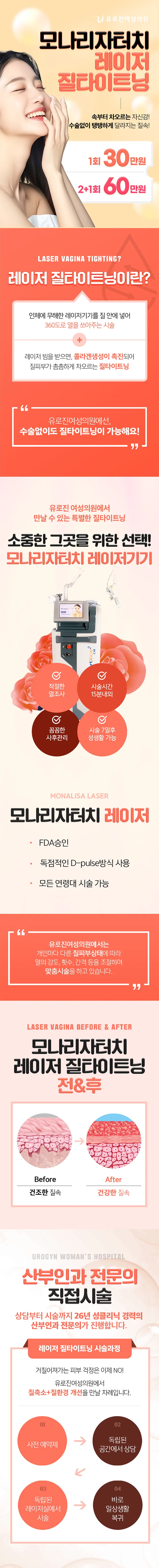 모나리자터치 레이저 질타이트닝 이벤트 - 1회 30만원, 2+1회 60만원. 레이저 질타이트닝 원리, 장비 특징, 시술 전후와 시술 과정 안내