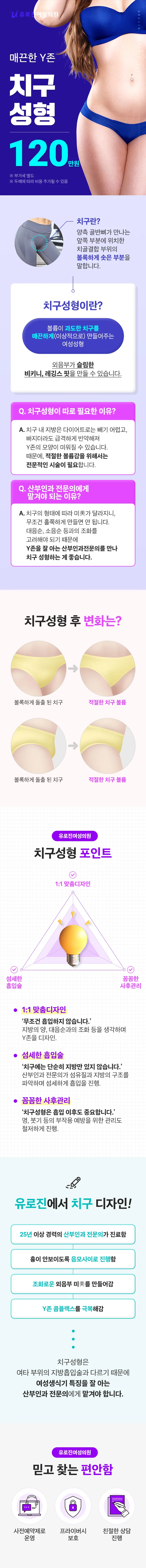 치구성형 이벤트 - 매끈한 Y존 치구성형 120만원(부가세 별도). 치구란 무엇인지, 시술 전후 변화, 치구성형 포인트 3가지 안내