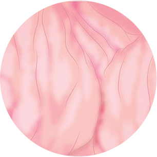 60대 질주름 - 주름이 거의 펴지고 창백해진 질벽 확대 그림