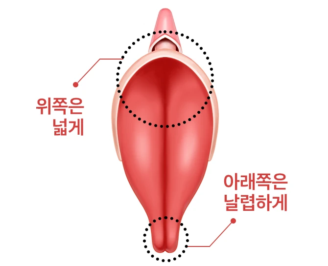 소음순의 위아래 비율을 표시한 도해