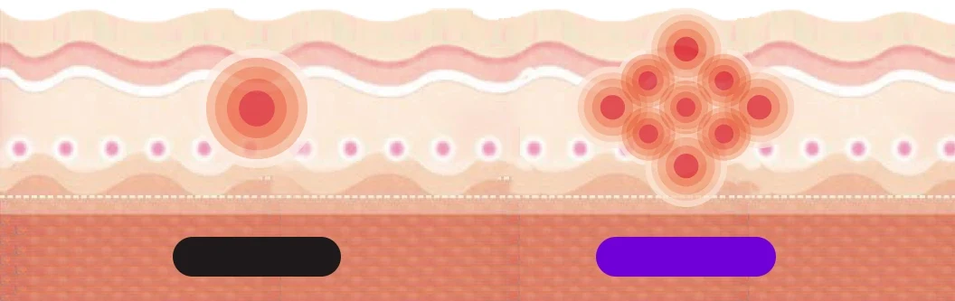 シングルウェーブとマルチウェーブで、皮膚の下に届く刺激の範囲を比較した図